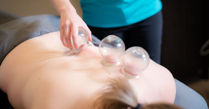 Cupping